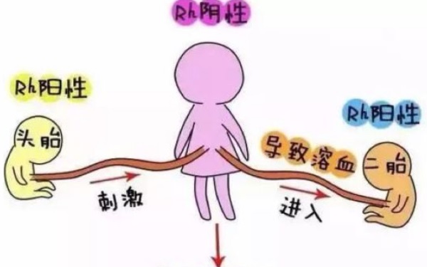 是什么意思?